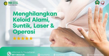 Cara Menghilangkan Keloid