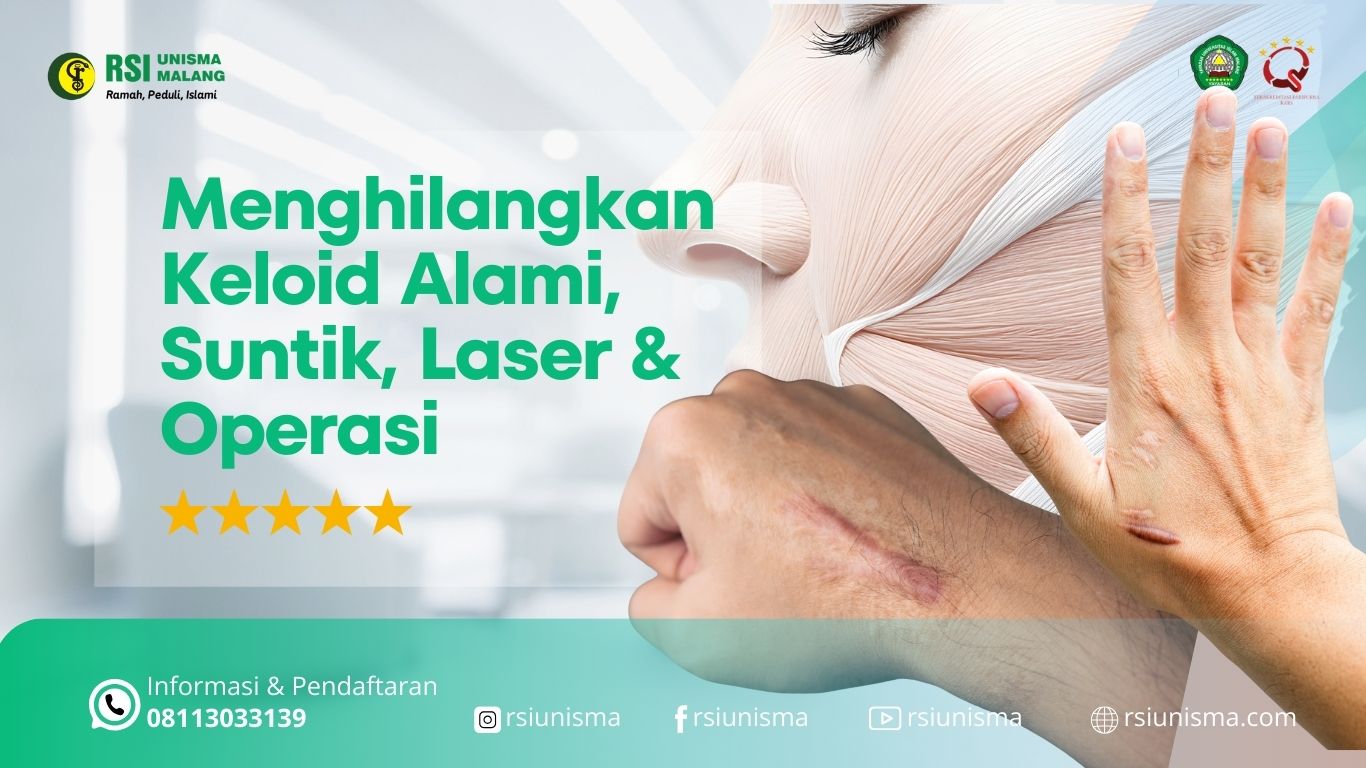 Cara Menghilangkan Keloid