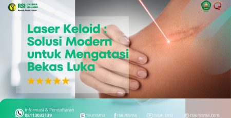 Laser Keloid di Malang